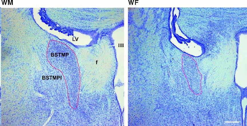 BSTMP.jpg (73537 bytes)